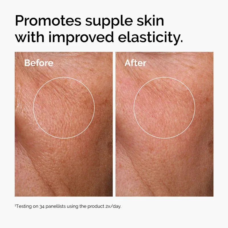 ord-hyaluronic-acid-2pct-b5-hydrating-serum-before-after-elasticity.webp