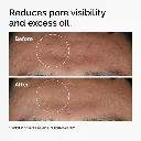 ord-niacinamide-zinc-blemish-serum-before-after-pores.webp