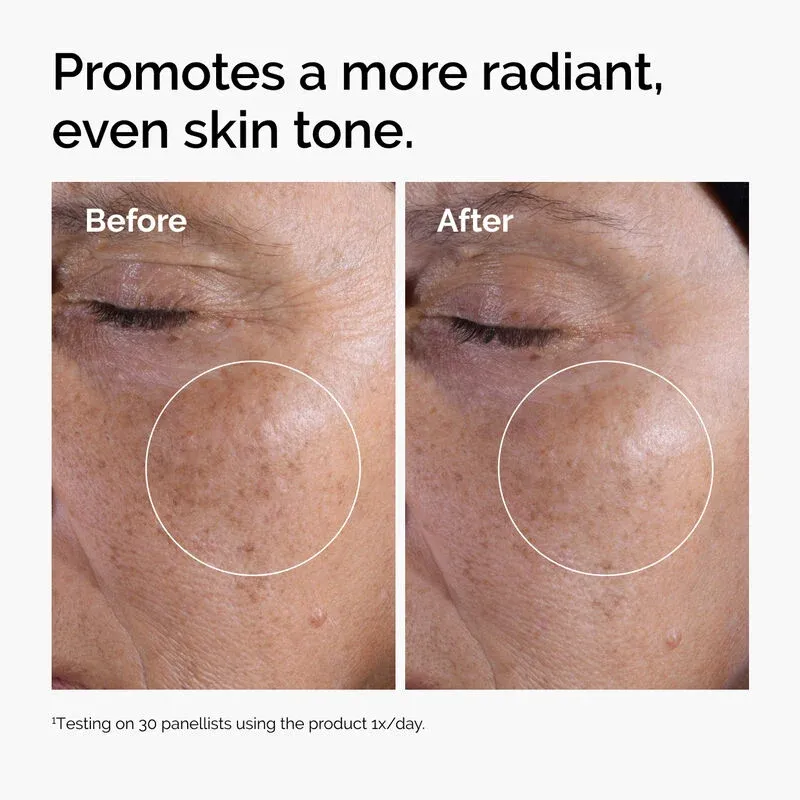 ord-glycolic-before-after-radiance.webp