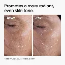 ord-glycolic-before-after-radiance.webp
